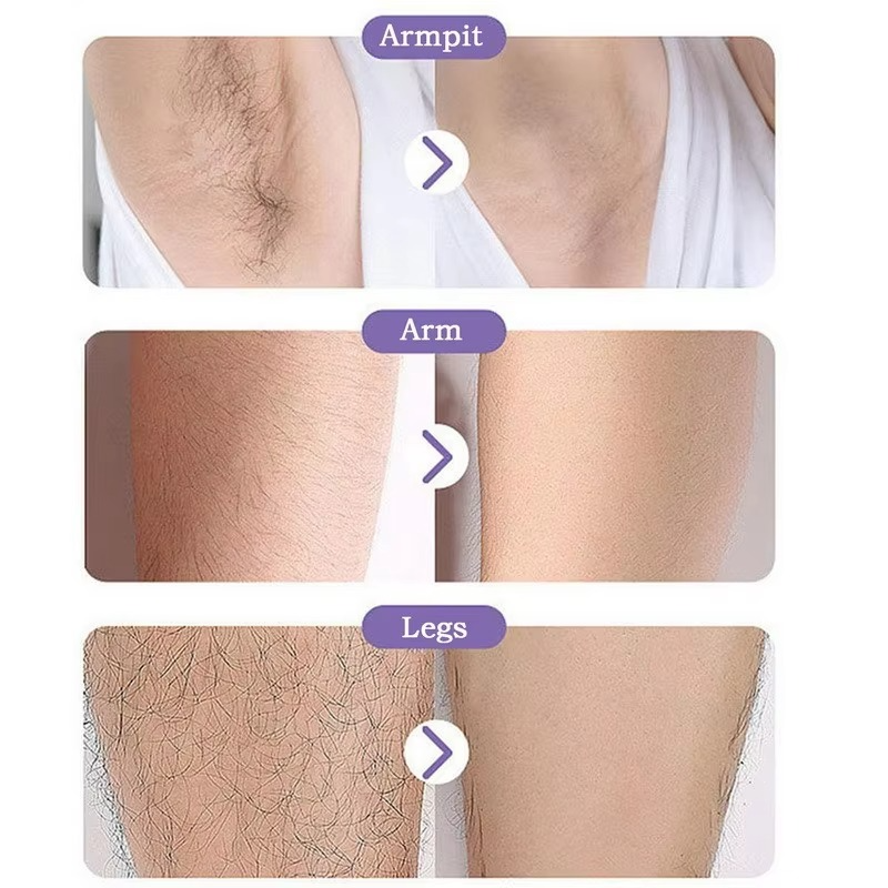 VelvEpil™ – Gomma Epilatoria in Cristallo Riutilizzabile IN OFFERTA 1+1 GRATIS!